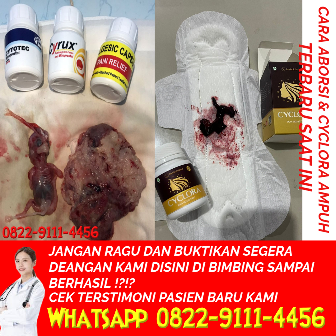 caramenggugurkankandungan